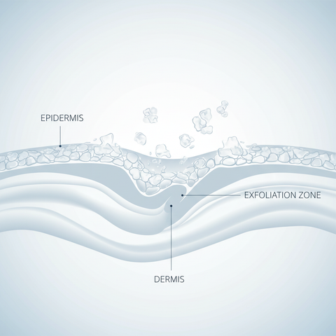 Exfoliates Dead Skin